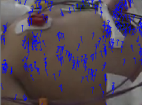 Neonate respiration paper thumbnail